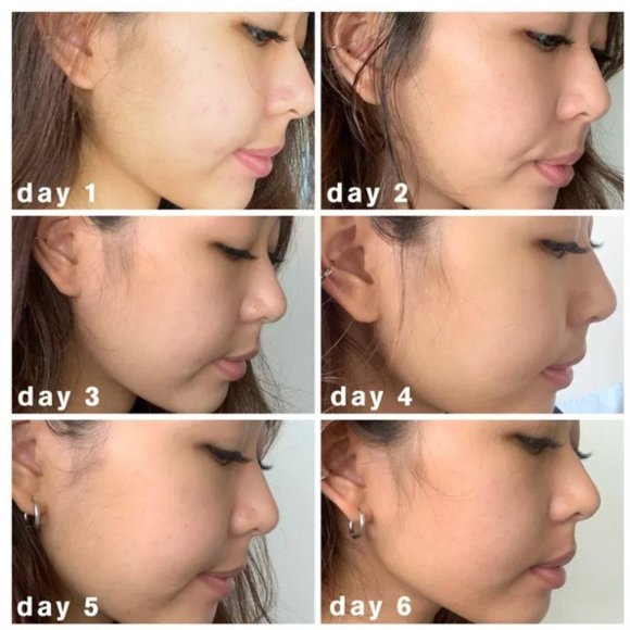 LARGE 330ML SK-II Anti Aging Facial Treatment Essence 11 oz. - Picture 4 of 5